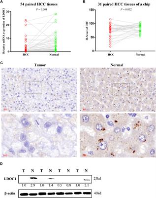 Leucine zipper downregulated in cancer 1 may serve as a favorable prognostic biomarker by influencing proliferation, colony formation, cell cycle, apoptosis, and migration ability in hepatocellular carcinoma